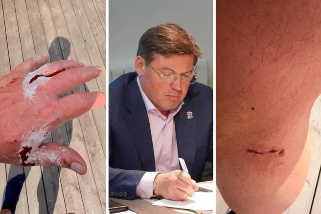 Экс‑депутат Алексей Денисенко получил пять ран, защищая свою собаку при нападении трёх бродячих псов у торговой точки на Северо‑Западе города; он обратился в травмпункт и считает, что закон об обращении с животными нужно ужесточить.