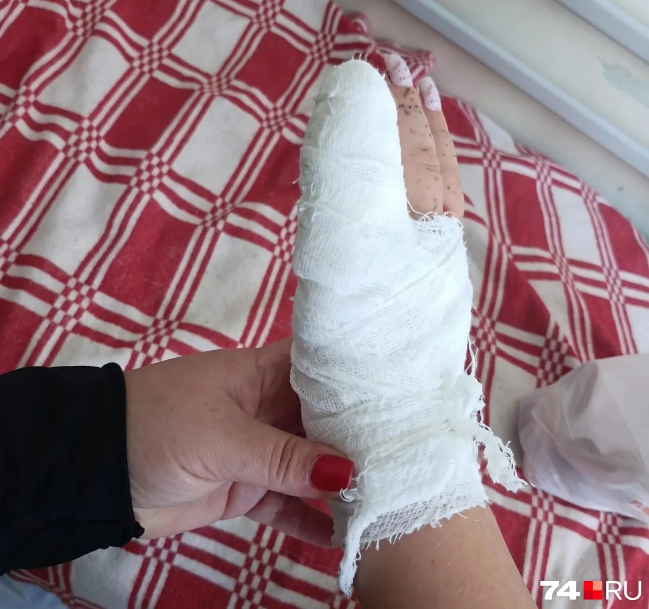 10-летняя девочка получила травму пальца во время игры на дворовой площадке в Ленинском районе; мать рассказала о госпитализации и длительном восстановлении.